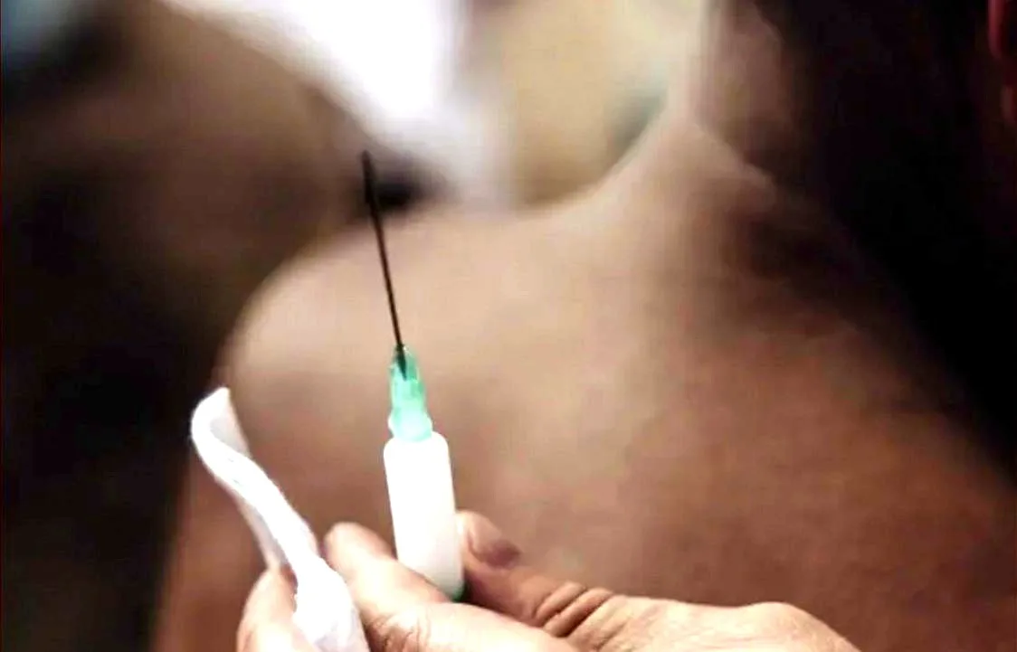 Close-up of a medical injection being administered